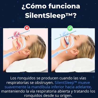 SilentSleep™- Boquilla antirronquidos de tamaño universal