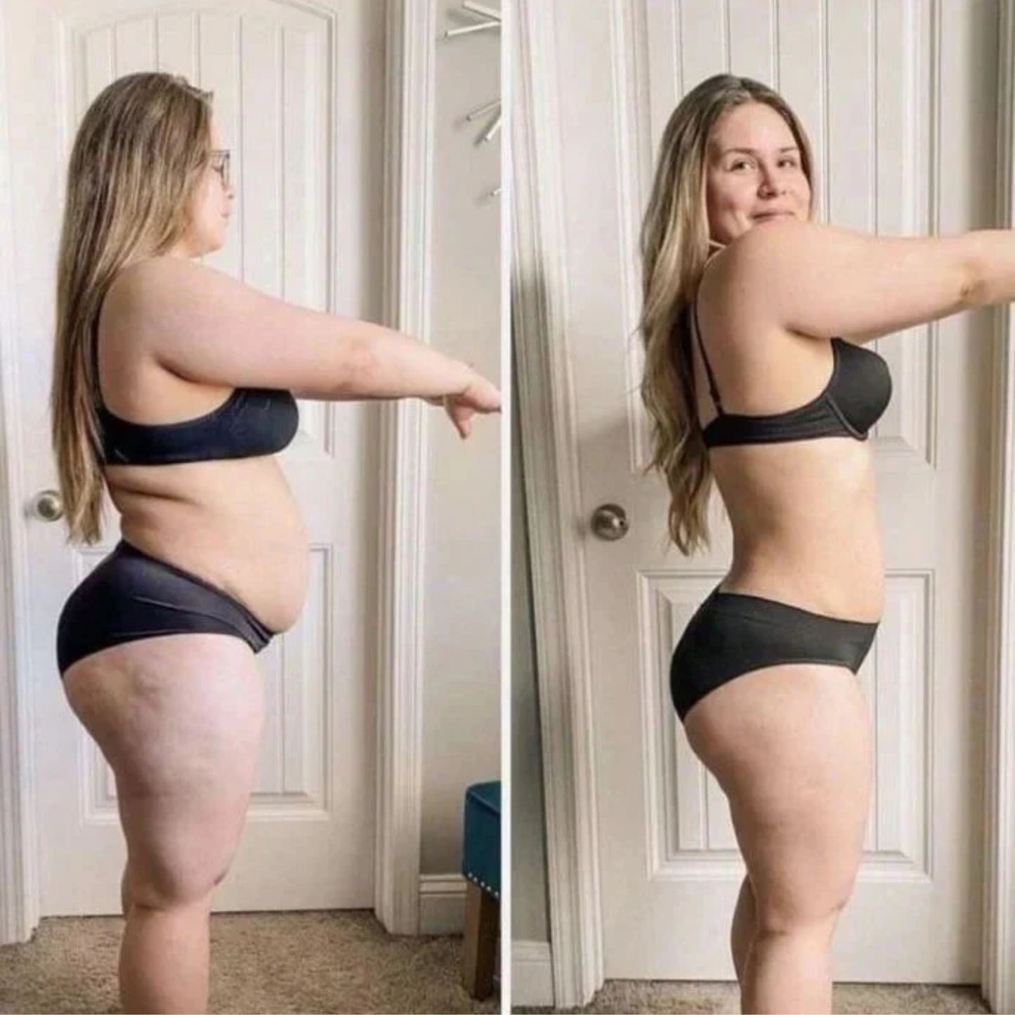 NatureParch GLP-1 N.° 1 Para Bajar De Peso